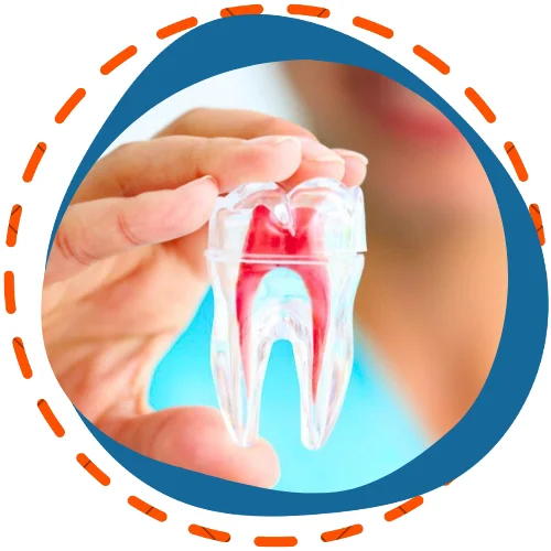 Endodoncia y tratamiento de conducto